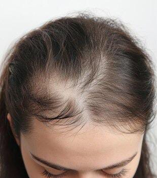 Before hair journey